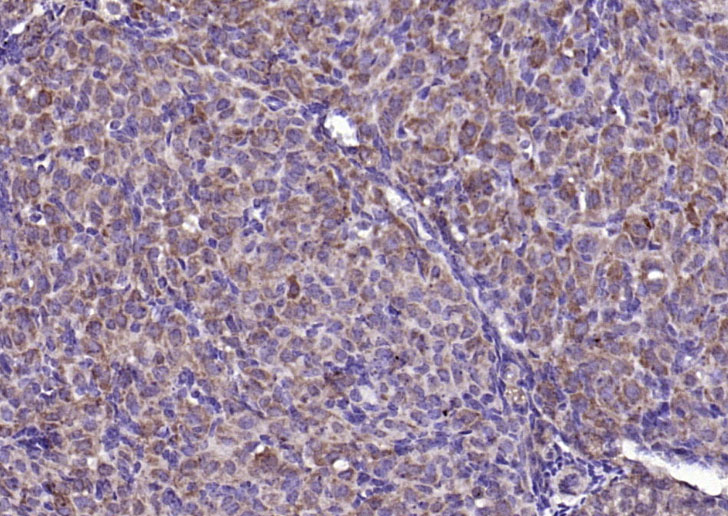 14 - FGF8 Rabbit pAb AP52199