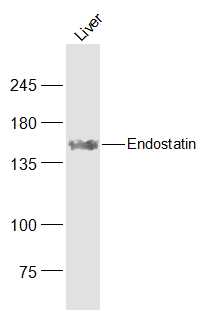 1 - Endostatin Rabbit pAb AP52200