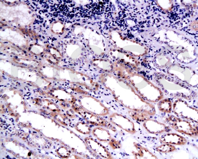 14 - Endostatin Rabbit pAb AP52200
