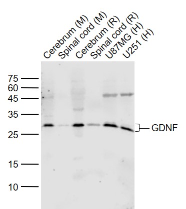 1 - GDNF Rabbit pAb AP52201