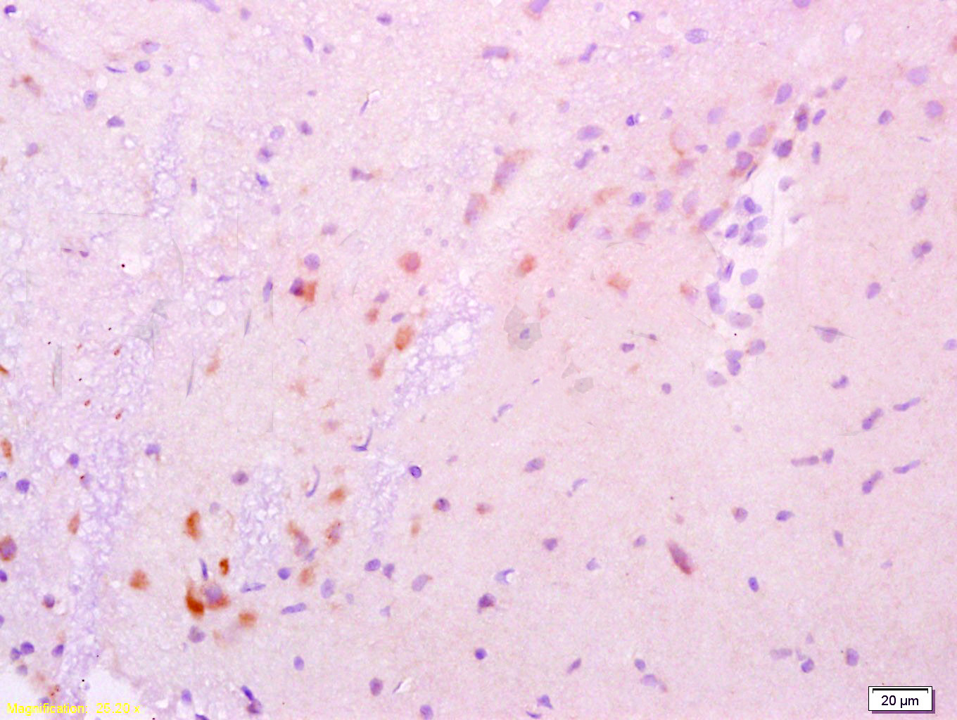 14 - GDNF Rabbit pAb AP52201