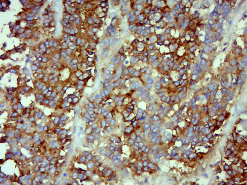 14 - CEA(C3) Mouse mAb AP52203