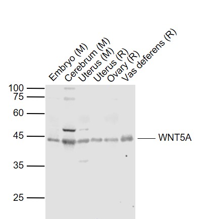 1 - WNT5A Rabbit pAb AP52204