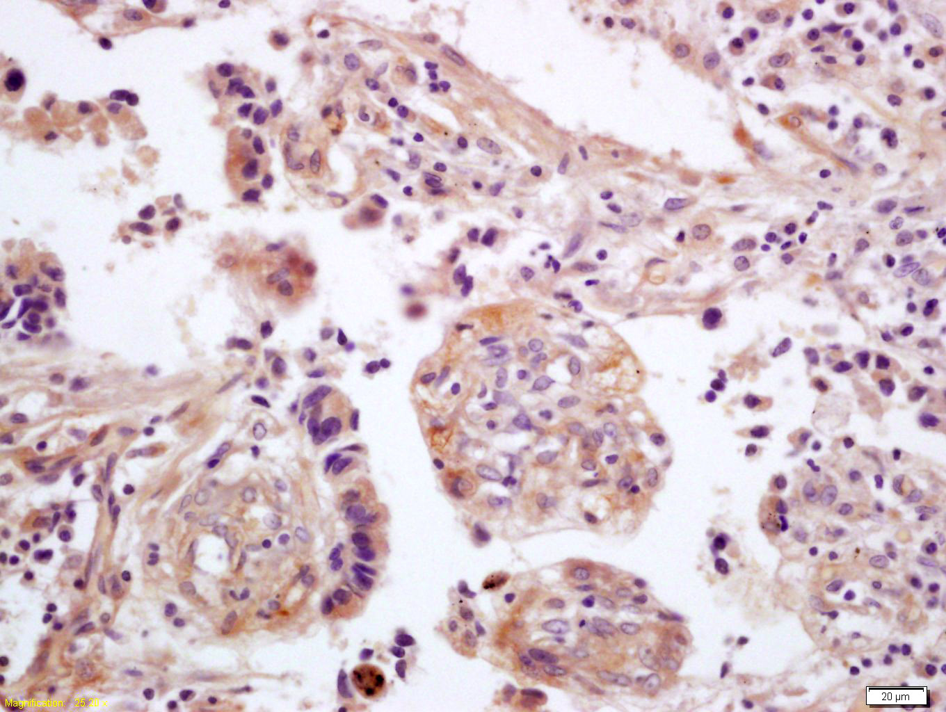 14 - WNT5A Rabbit pAb AP52204