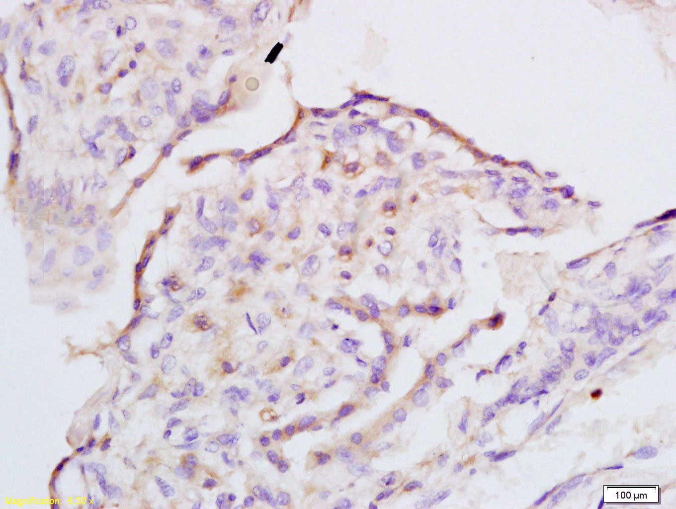 14 - IQGAP1 Rabbit pAb AP52210