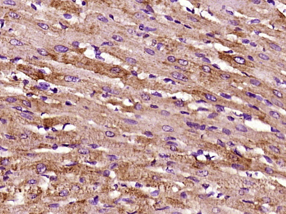 14 - TFPI-2 Rabbit pAb AP52213