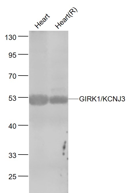 1 - GIRK1/KCNJ3 Rabbit pAb AP52214