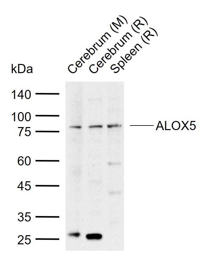 1 - ALOX5 Rabbit pAb AP52215