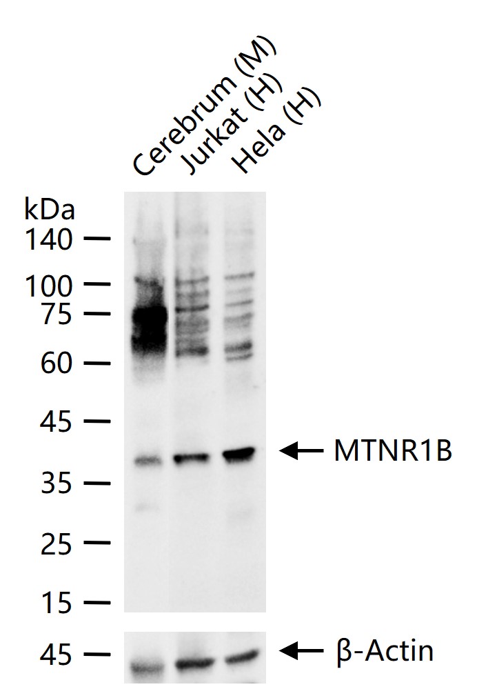 1 - MTNR1B Rabbit pAb AP52216