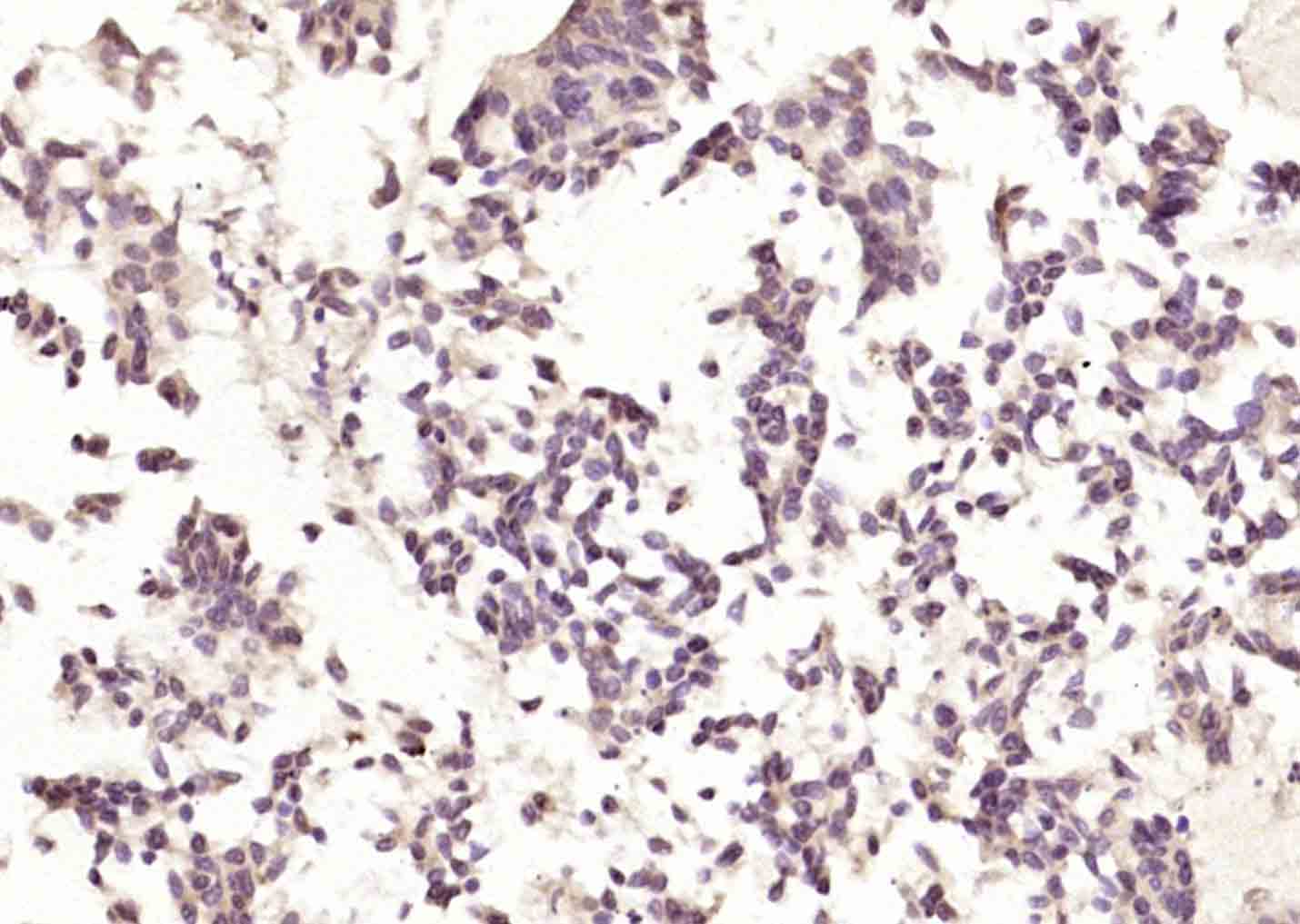 14 - phospho-Bcl-2 (Ser70) Rabbit pAb AP52218