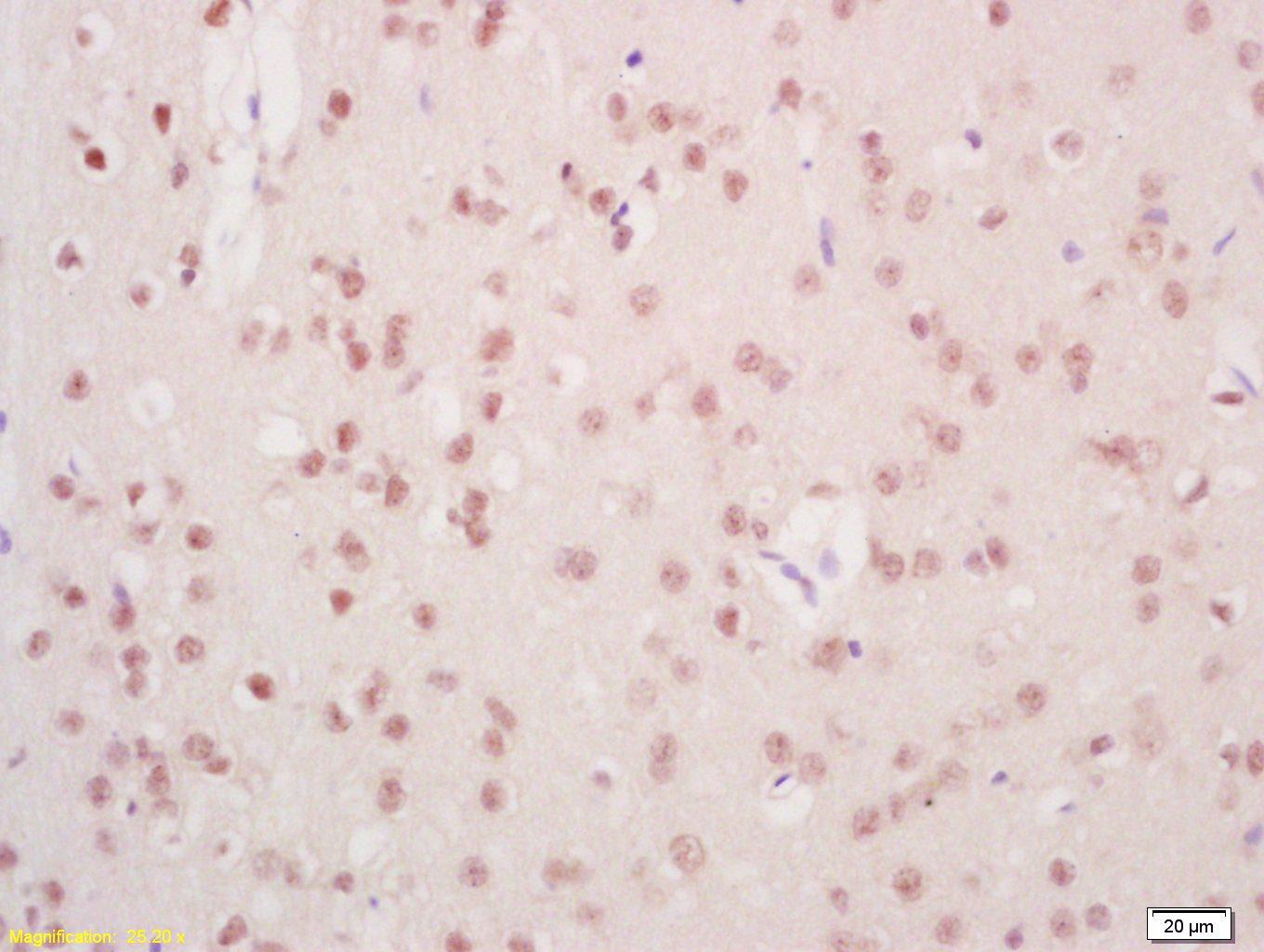 14 - Mre11 Rabbit pAb AP52219