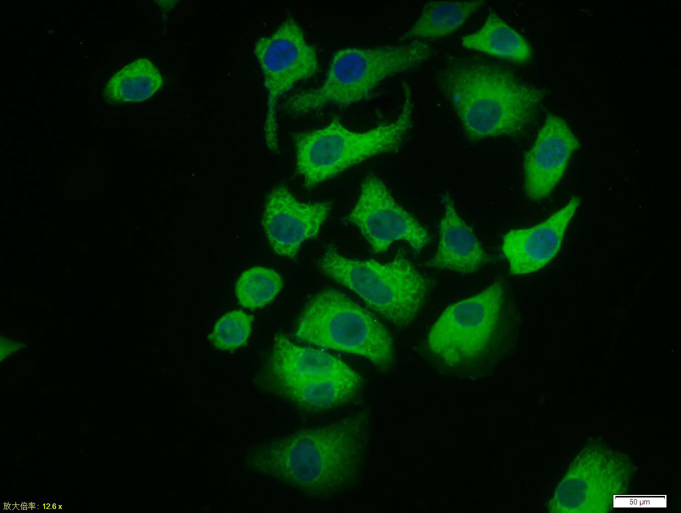 0 - phospho-ERK1/ERK2(phospho-T183/Y185) Rabbit pAb AP52229