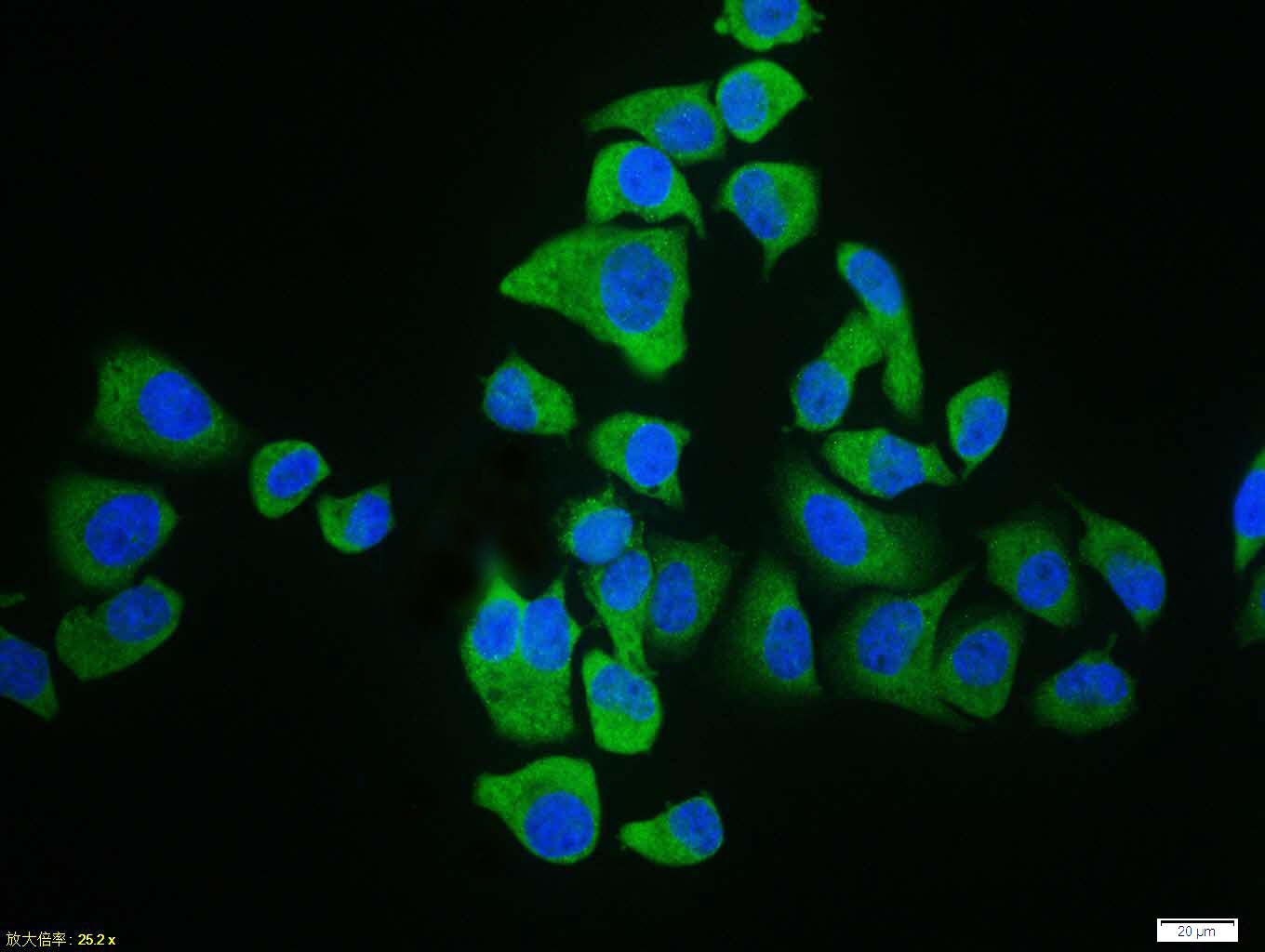 0 - UCP-2 Rabbit pAb AP52232