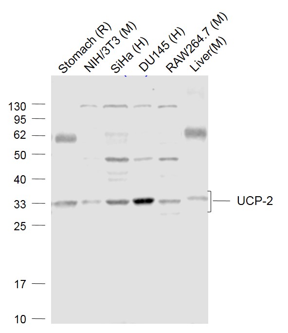 1 - UCP-2 Rabbit pAb AP52232