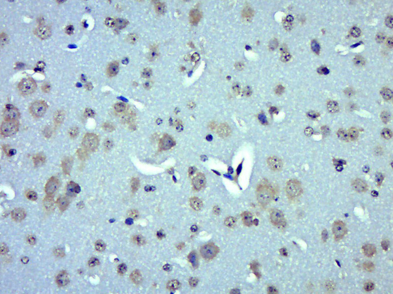 14 - UCP-2 Rabbit pAb AP52232