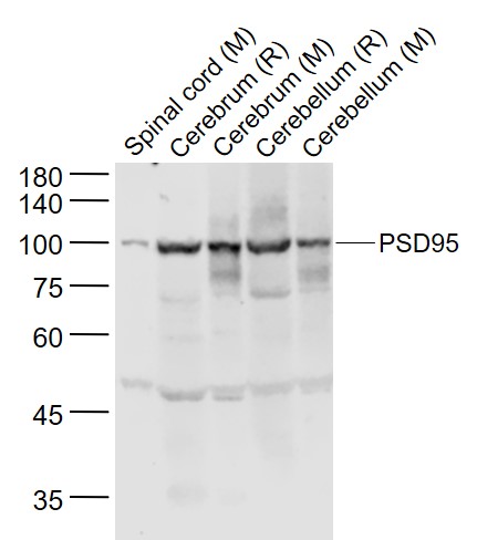 1 - PSD95 Rabbit pAb AP52233