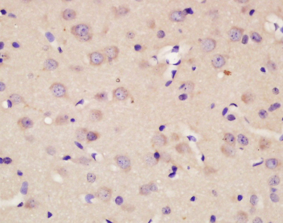 14 - CMKLR1 Rabbit pAb AP52238