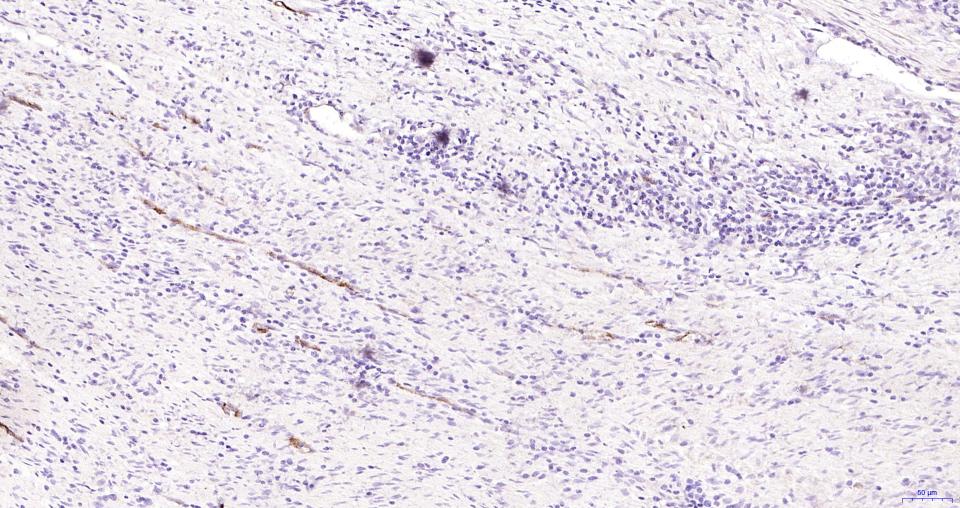 14 - CD62p Rabbit pAb AP52242