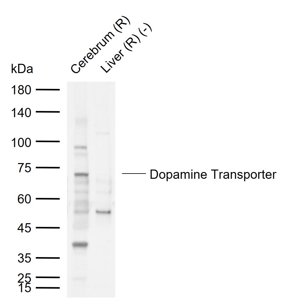 1 - Dopamine Transporter Rabbit pAb AP52244