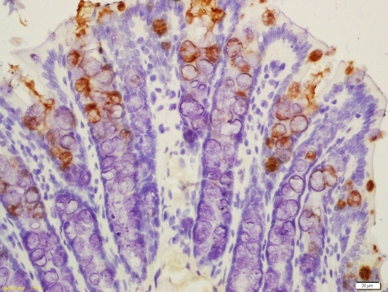 14 - TFF3 Rabbit pAb AP52248