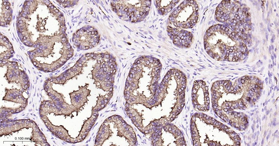 14 - LGALS3BP Rabbit pAb AP52251