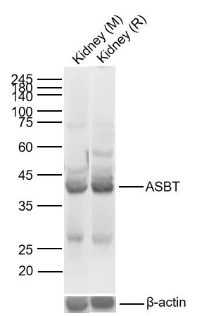 1 - SLC10A2 Rabbit pAb AP52254