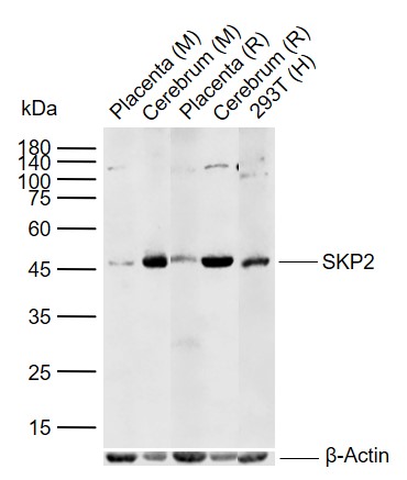 1 - SKP2 Rabbit pAb AP52260