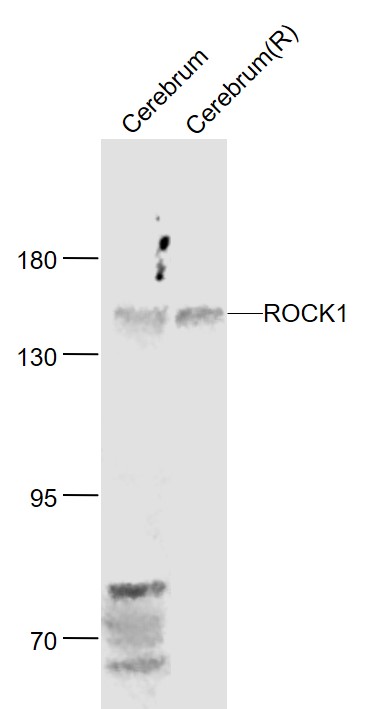 1 - ROCK1 Rabbit pAb AP52261