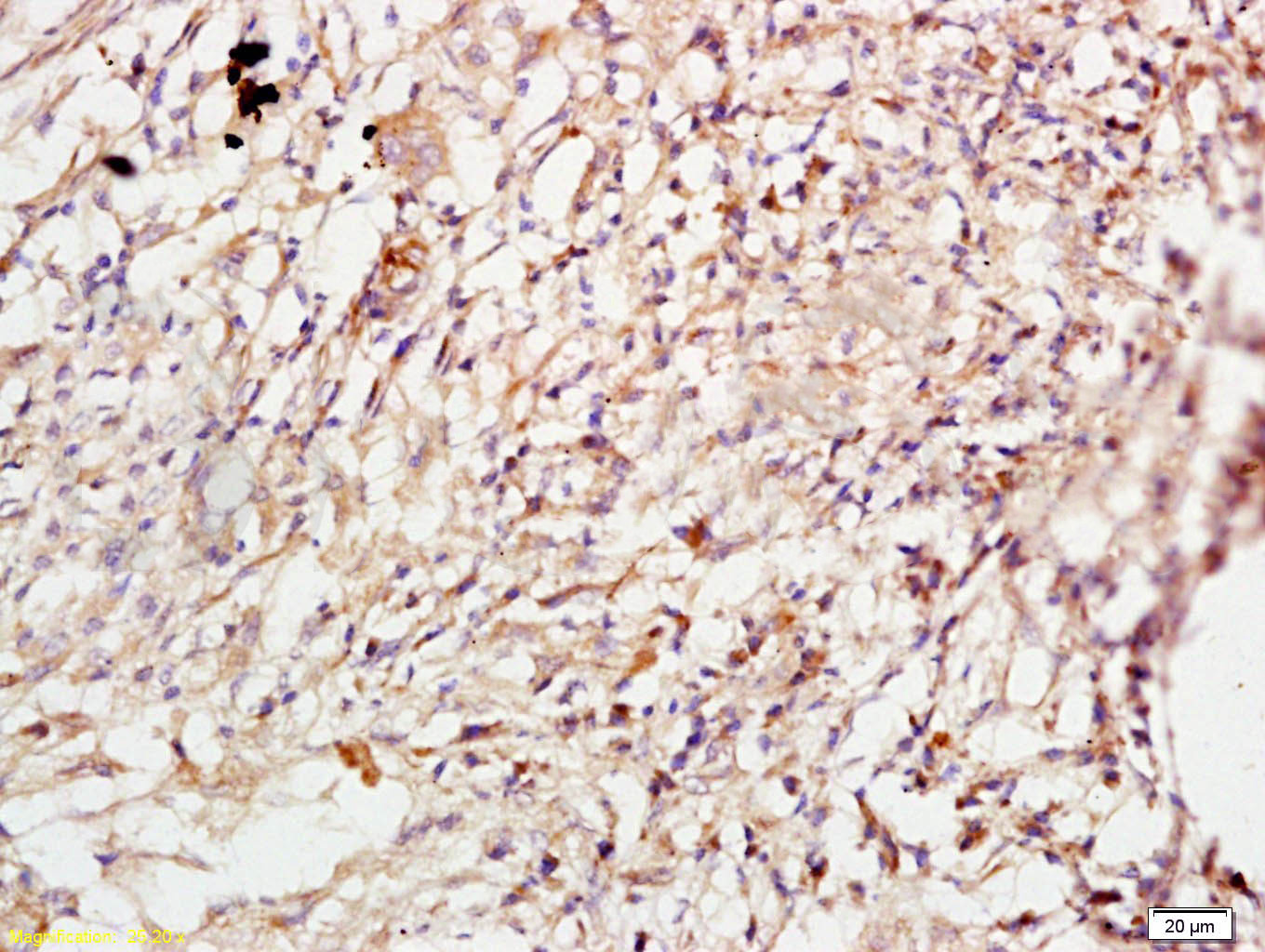 14 - ROCK1 Rabbit pAb AP52261