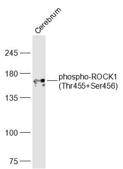 1 - phospho-ROCK1 (Thr455+Ser456) Rabbit pAb AP52262