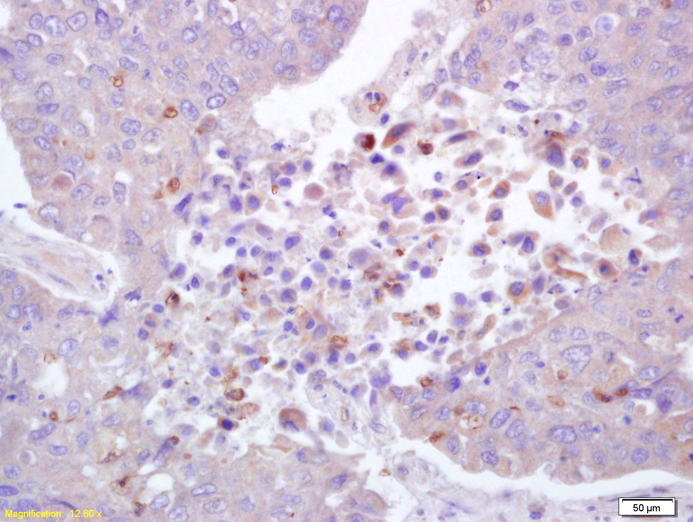 14 - phospho-ROCK1 (Thr455+Ser456) Rabbit pAb AP52262