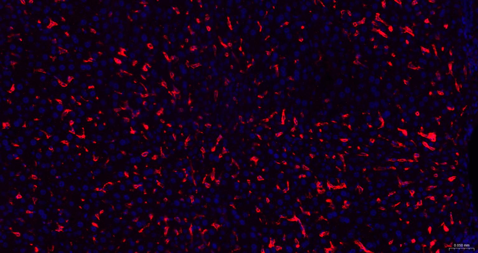 3 - ADGRE1 Rabbit pAb AP52265