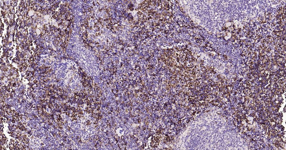 14 - ADGRE1 Rabbit pAb AP52265