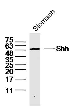 1 - Shh Rabbit pAb AP52268