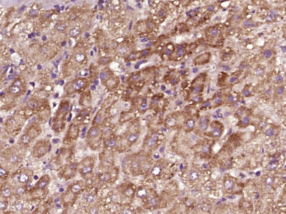 14 - Ceramide glucosyltransferase Rabbit pAb AP52273