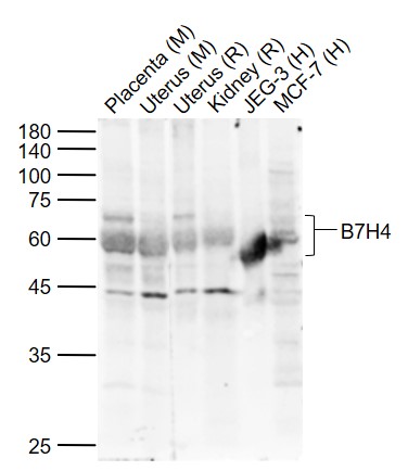 1 - B7H4 Rabbit pAb AP52276