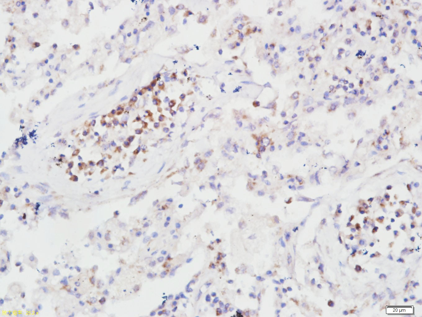 14 - B7H4 Rabbit pAb AP52276