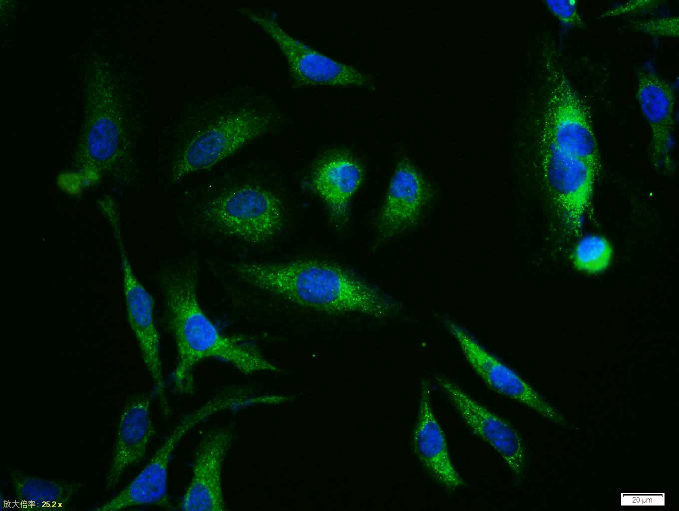 0 - XIAP/BIRC4 Rabbit pAb AP52278