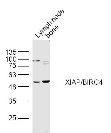 1 - XIAP/BIRC4 Rabbit pAb AP52278