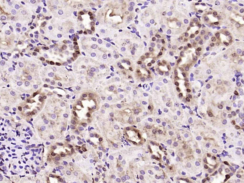 14 - JNK1+JNK2+JNK3 Rabbit pAb AP52280