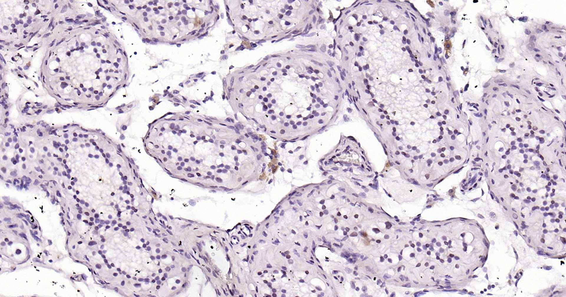 14 - SPATA12 Rabbit pAb AP52286