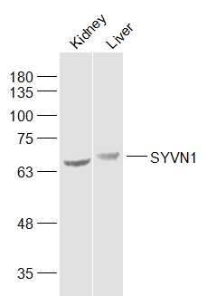 1 - SYVN1 Rabbit pAb AP52288