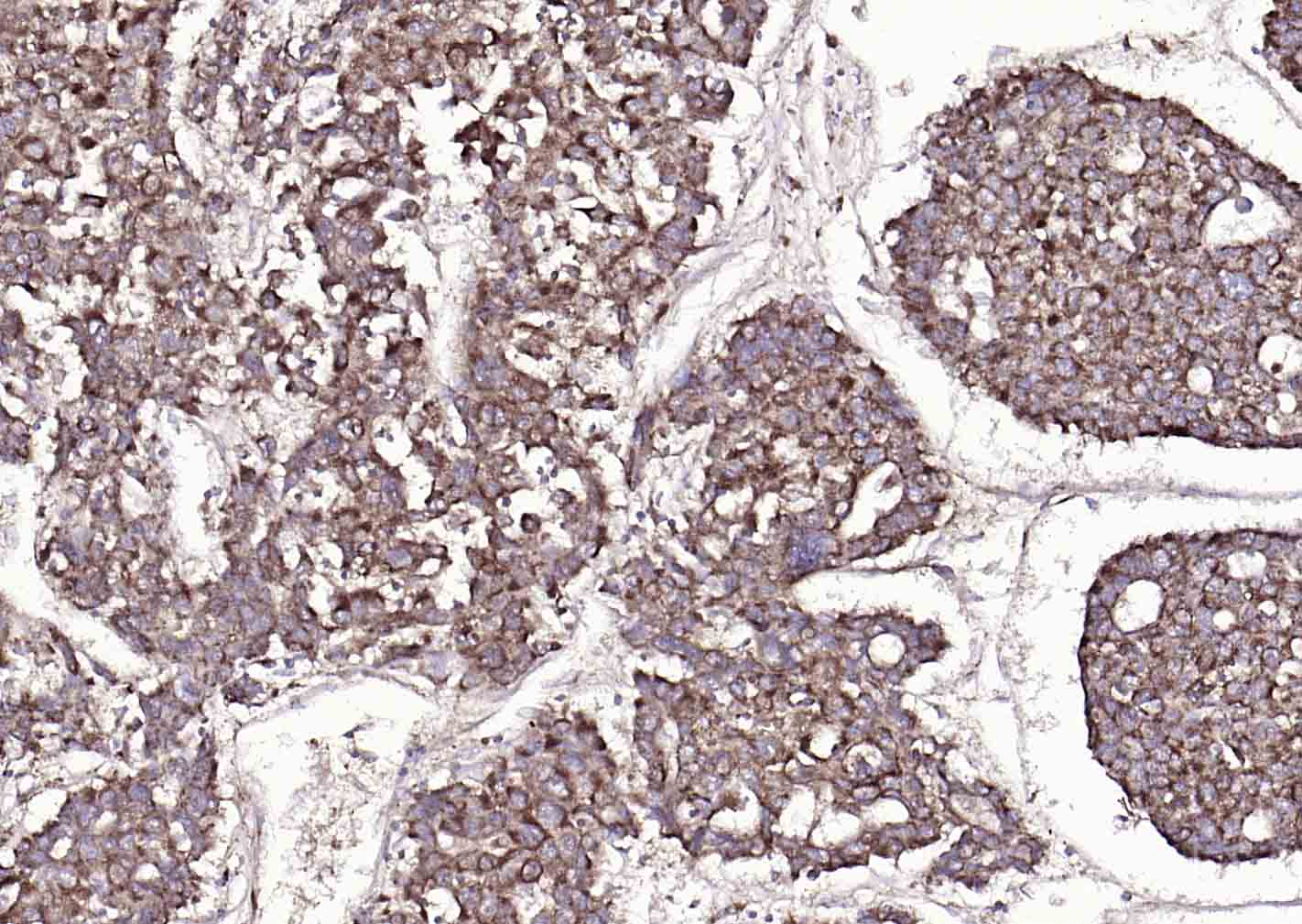 14 - SYVN1 Rabbit pAb AP52288