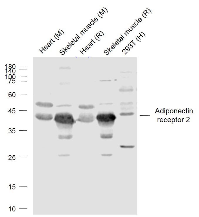 1 - ADIPOR2/PAQR2 Rabbit pAb AP52290