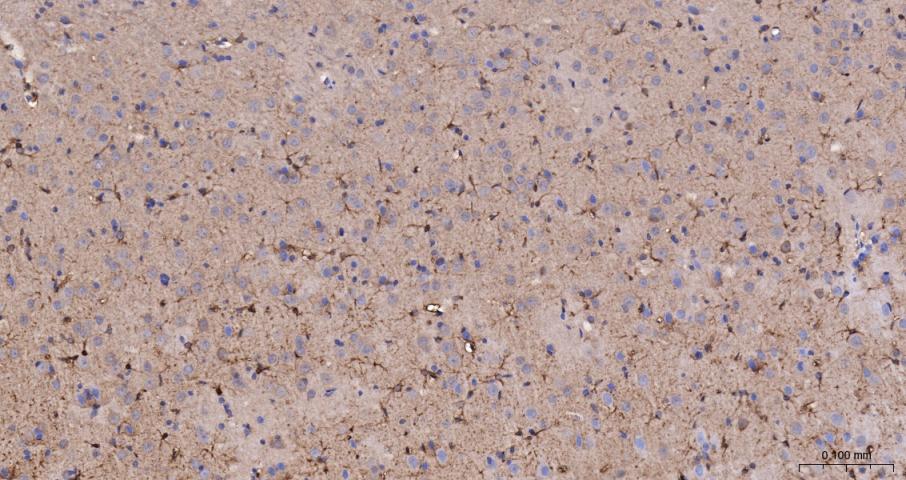 14 - ADIPOR2/PAQR2 Rabbit pAb AP52290