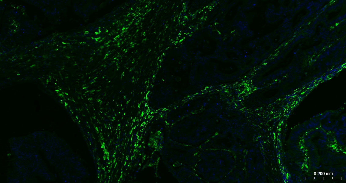 3 - CD163 Rabbit pAb AP52291