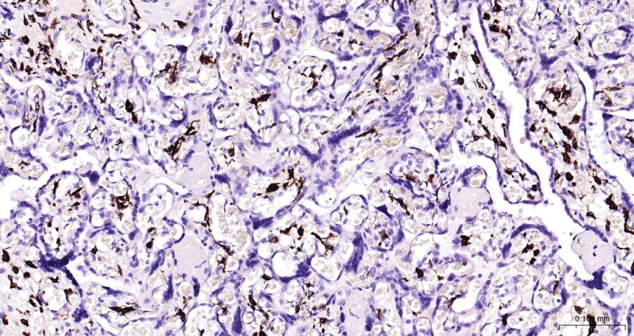 14 - CD163 Rabbit pAb AP52291