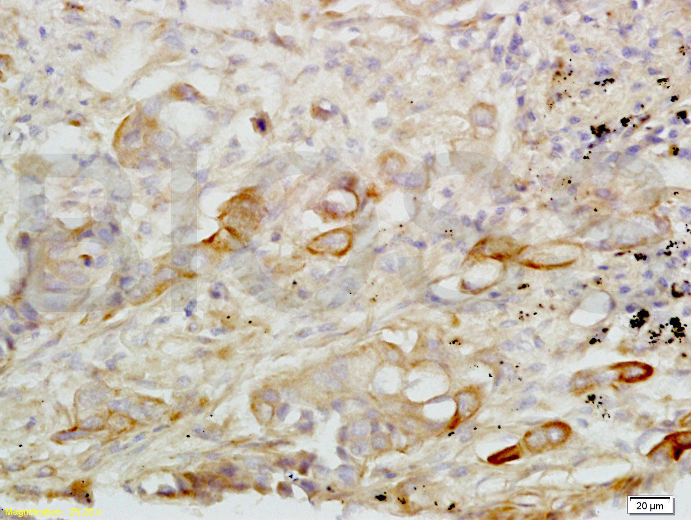 14 - CXCL16 Rabbit pAb AP52293