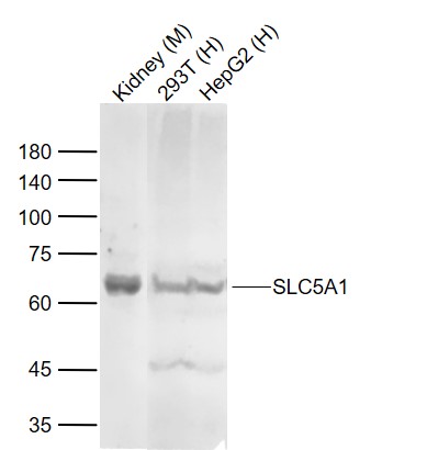 1 - SLC5A1 Rabbit pAb AP52294