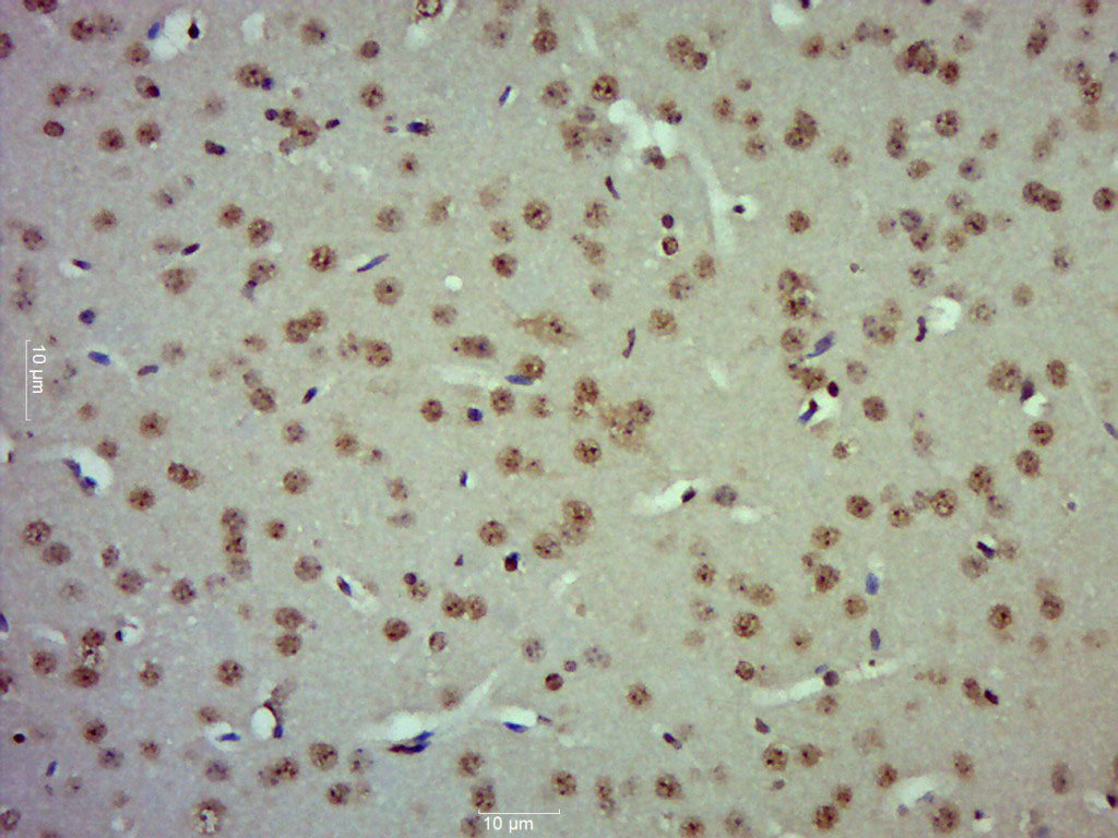 14 - ZBTB2 Rabbit pAb AP52296